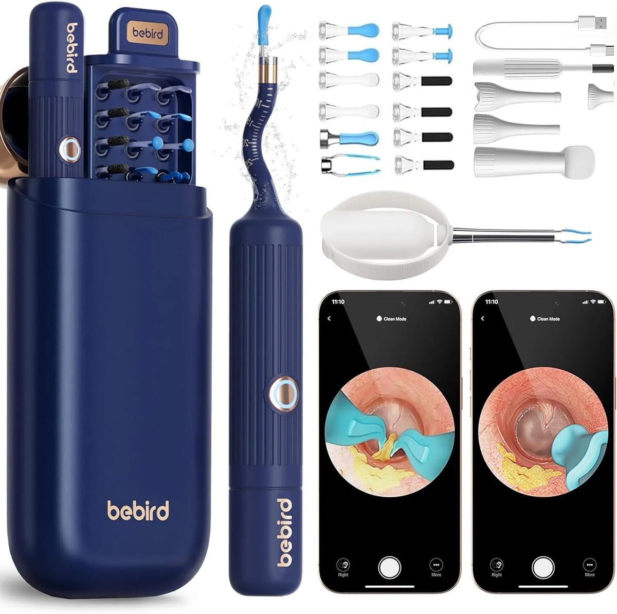 Earsight Plus Ohrenschmalz-Entfernungsset zur Kamera-Reinigung, flexible Linsen aus Silikon, HD drahtloses Otoskop, schmerzfreie Ohrpinzette und